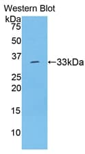 SERPINA7 / TBG Antibody (aa114-391)