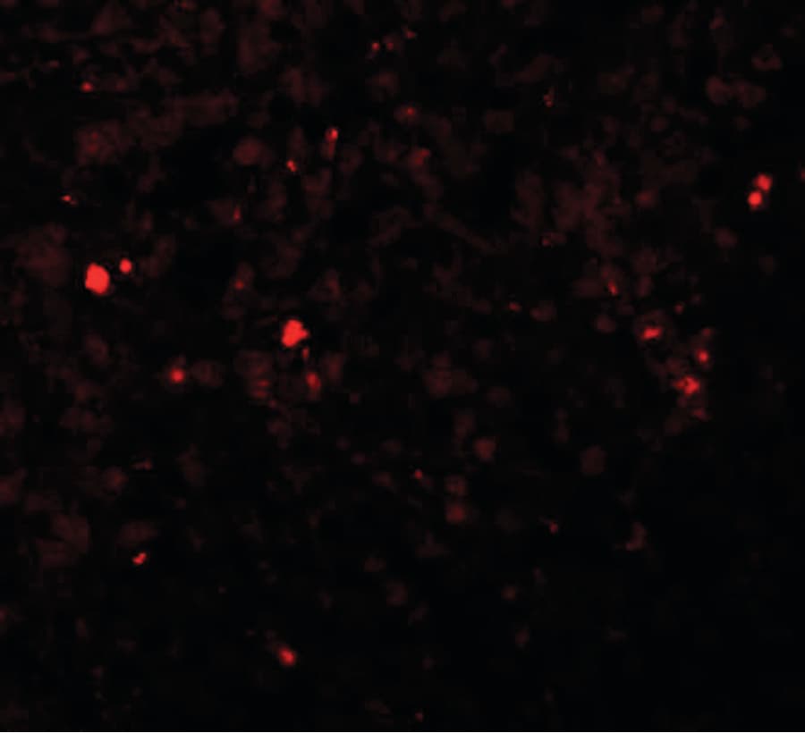 Polyclonal Rabbit anti-Human SLC39A13 / ZIP13 Antibody (IHC, IF, WB)