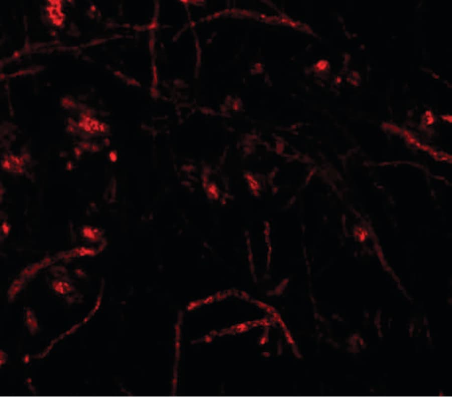 ZFP219 / ZNF219 Antibody