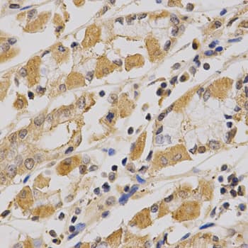 PRKAA1 / AMPK Alpha 1 Antibody