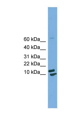 Polyclonal Rabbit anti-Human PPIH / Cyclophilin H Antibody (aa71-120, WB)