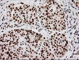 LOX / Lysyl Oxidase Antibody (clone OTI9G2)