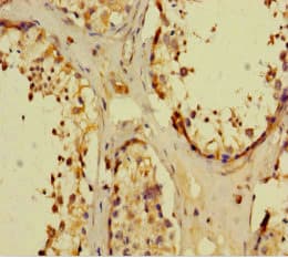 Polyclonal Rabbit anti-Human NR1I3 / CAR Antibody (WB)