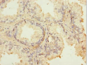 FIBP Antibody