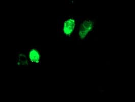 Adiponectin Antibody (aa19-244, clone OTI1B2, Carrier-free)