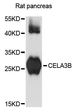CELA3B / ELA3B Antibody