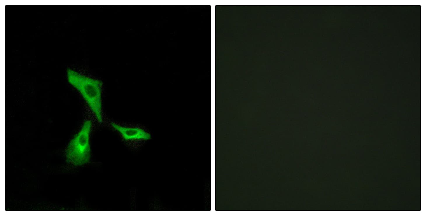 IHC-plus™ GPCR6 / GPR101 Antibody (aa451-500)