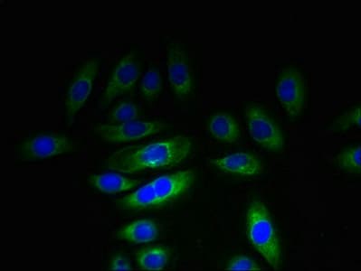 KHDC1 / C6orf148 Antibody