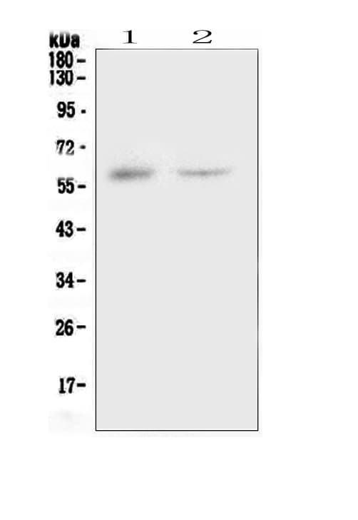 CSF1 / MCSF Antibody