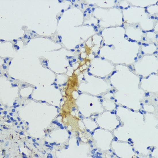 KLKB1 / Plasma Kallikrein Antibody
