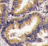 URM1 Antibody (aa8-40)
