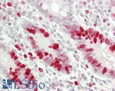 MKI67 / Ki67 Antibody (DY488)