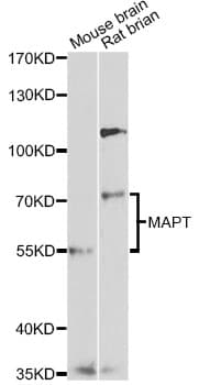 Polyclonal Rabbit anti-Human MAPT / Tau Antibody (IHC, IF, WB)