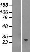 SNRPB / COD Protein (Over-Expression Lysate Myc-DDK (Flag))