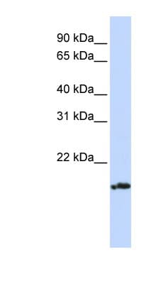 Polyclonal Rabbit anti-Human PLDN / Pallidin Antibody (aa36-85, WB)