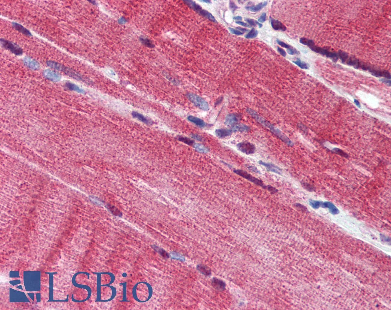 IHC-plus™ DCAF6 / NRIP Antibody (aa800-850)