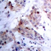 ARHGAP23 Antibody (Internal)