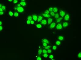 Monoclonal Mouse anti-Human NTRK3 / TRKC Antibody (clone OTI4E10, IHC, IF, WB)