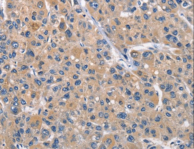 Polyclonal Rabbit anti-Human CLEC2D / OCIL / LLT1 Antibody (IHC)