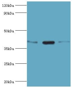 TWF2 / PTK9L Antibody (aa1-369)