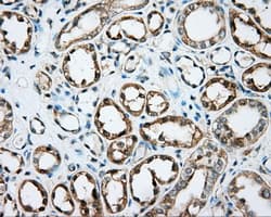 Monoclonal Mouse anti-Human DNTTIP1 / TDIF1 Antibody (clone OTI1F4, IHC, IF, WB)