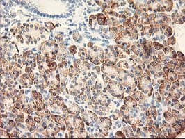 RPN1 / Ribophorin I Antibody (clone OTI2E3)