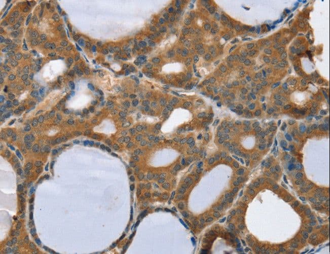 TRIM3 Antibody