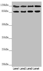 Polyclonal Rabbit anti-Human SCYL1 / NTKL Antibody (WB)