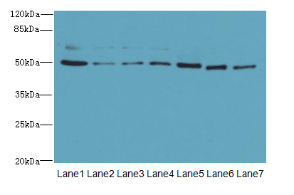 ZNF398 Antibody