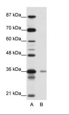 HIF1AN Antibody (N-Terminus)