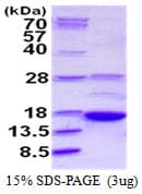 Human AKAP7 Protein (Recombinant His)