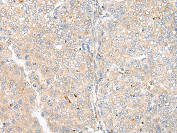 CAMK2A / CaMKII Alpha Antibody