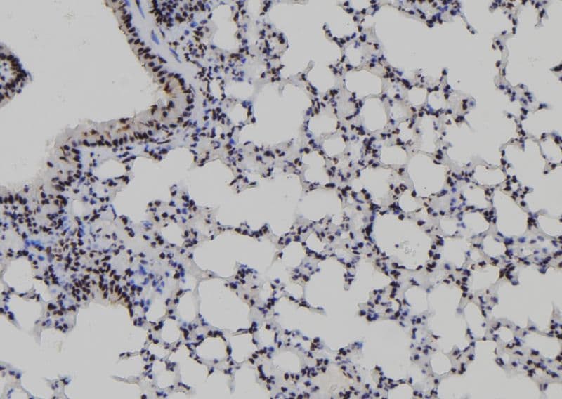 Polyclonal Rabbit anti-Human MYBL2 Antibody (IHC, WB)
