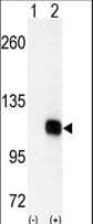 DGKZ Antibody (aa989-1019)