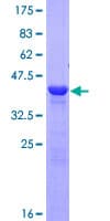 Human CRYGD / CCP Protein (Recombinant GST)