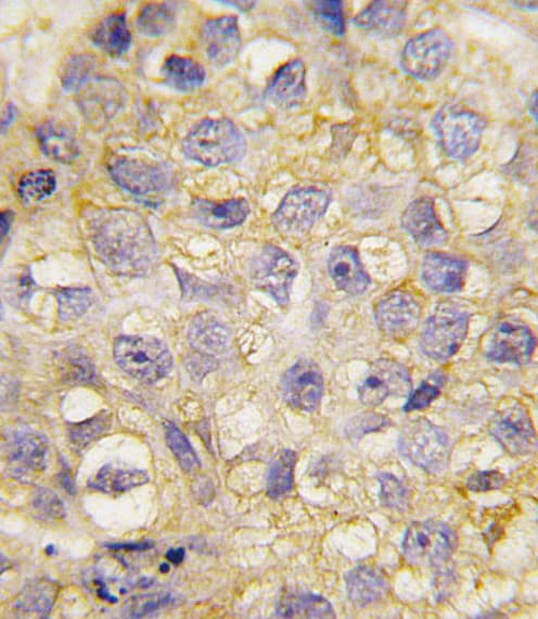 EPHB2 / EPH Receptor B2 Antibody (aa1021-1050)