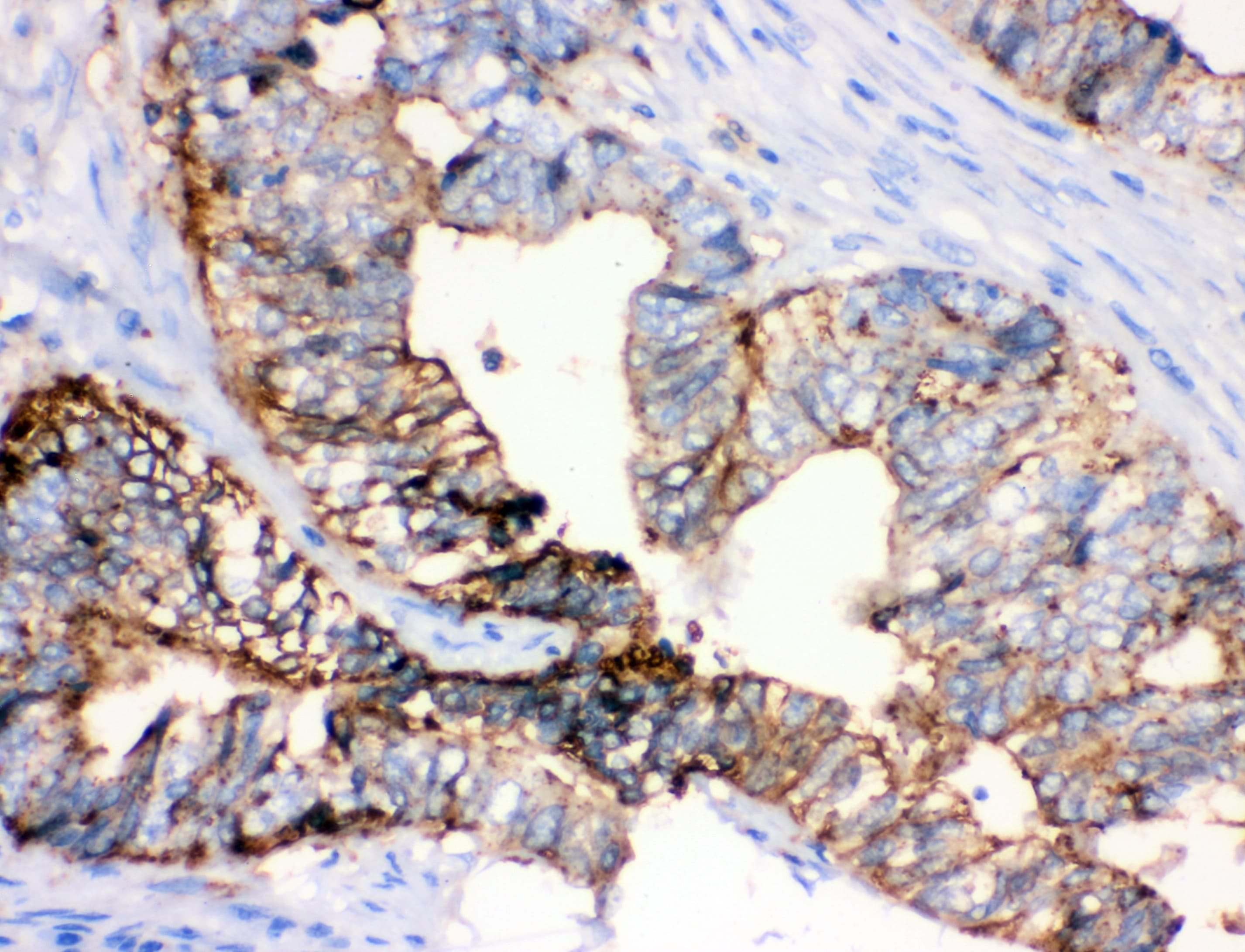 ANXA4 / Annexin IV Antibody