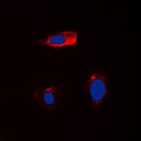 IHC-plus™ Polyclonal Rabbit anti-Human CST1 / Cystatin SN Antibody (Internal, IHC, IF, WB)
