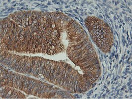 Monoclonal Mouse anti-Human FDFT1 / Squalene Synthase Antibody (clone OTI2F10, IHC, IF, WB)