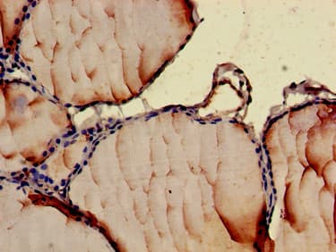 CCL3 / MIP-1-Alpha Antibody