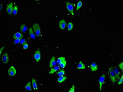 Polyclonal Rabbit anti-Human MTNR1B / MT2 Antibody (IHC, IF)
