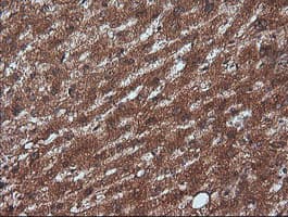 RTKN / Rhotekin Antibody (clone OTI2E9)