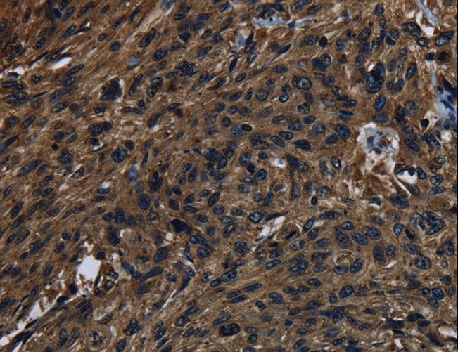 Polyclonal Rabbit anti-Human KLK14 / Kallikrein 14 Antibody (IHC, WB)