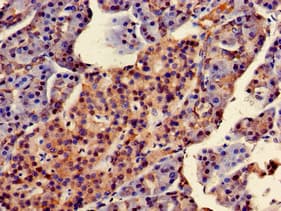 Polyclonal Rabbit anti-Human SCG10 / STMN2 Antibody (IHC, IF)
