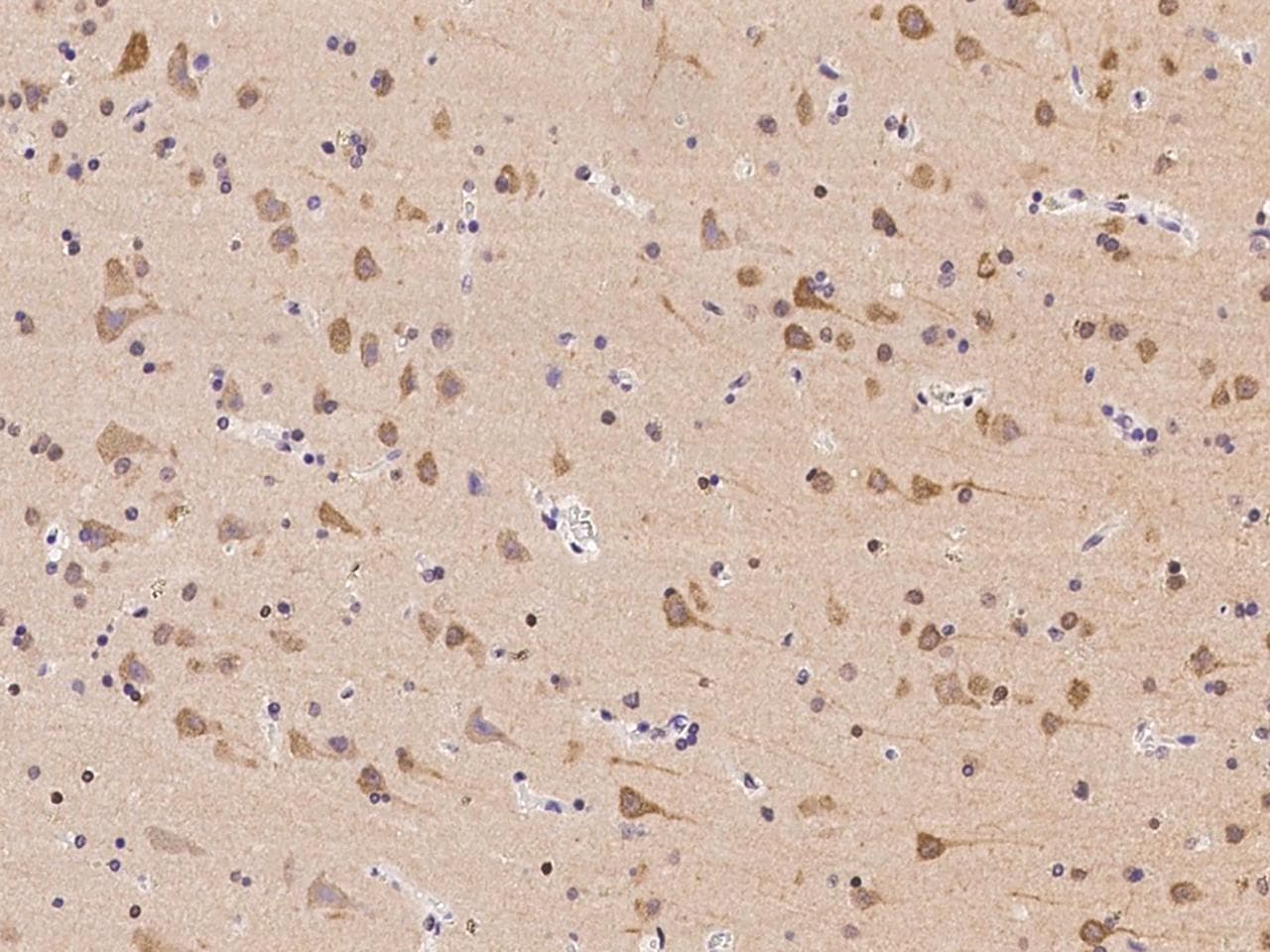 Polyclonal Rabbit anti-Human TTBK1 Antibody (IHC)