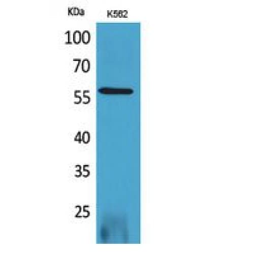 CBFA1 / RUNX2 Antibody (191-240 aa, Internal)