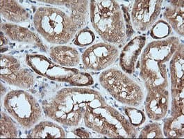 MAP2K1 / MKK1 / MEK1 Antibody (clone OTI7B1)