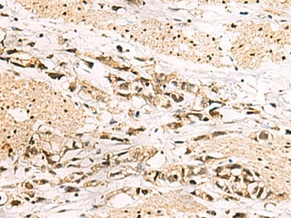 Polyclonal Rabbit anti-Human LRIF1 / RIF1 Antibody (IHC)