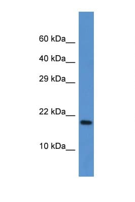 FXN / Frataxin Antibody (aa105-154)
