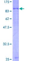 Human ARAF / ARAF1 / A-RAF Protein (Recombinant GST)